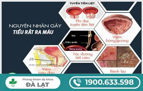 Hình ảnh minh họa